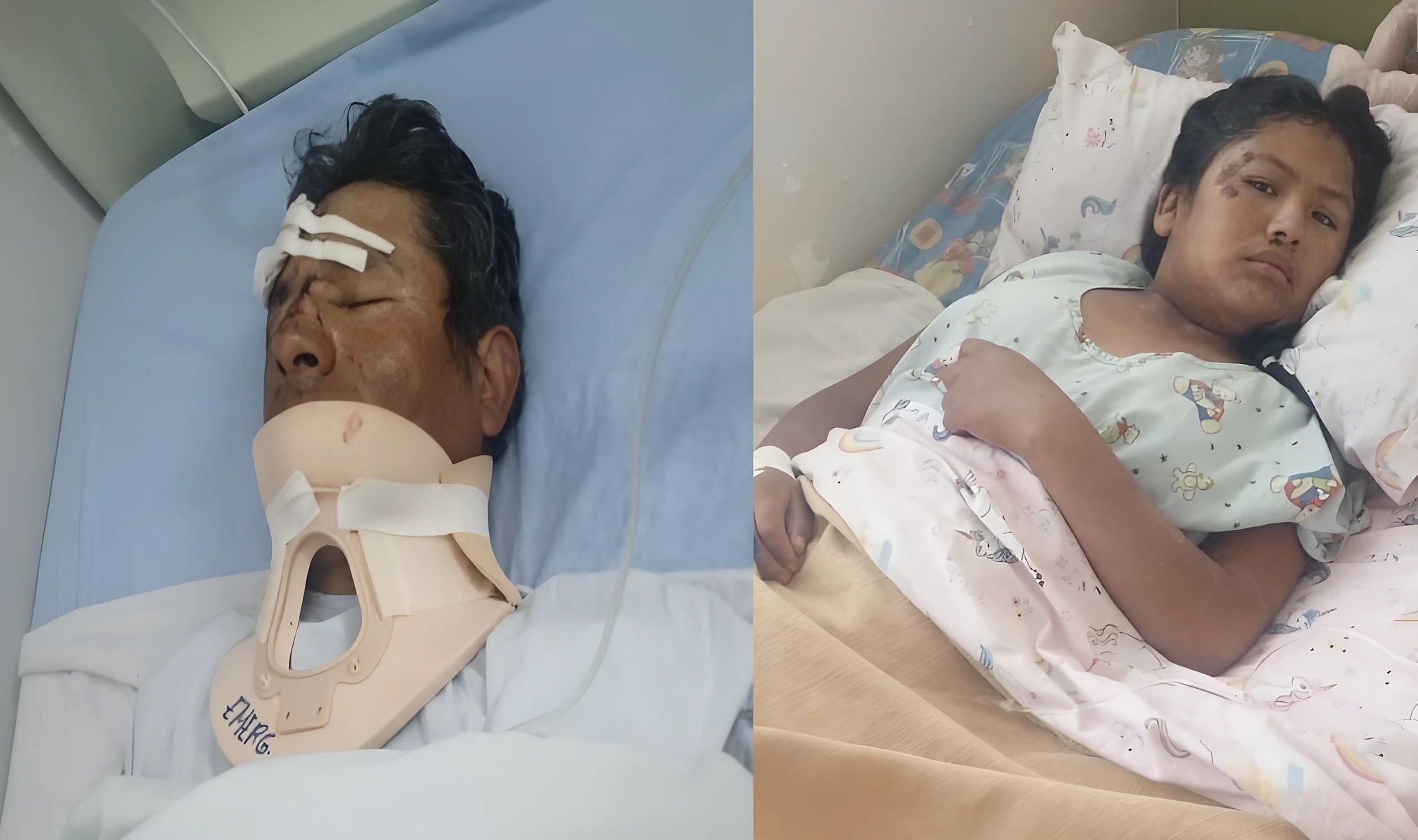 Padre e hija se accidentan y requieren ayuda para recuperarse Padre e hija se accidentan y requieren ayuda para recuperarse